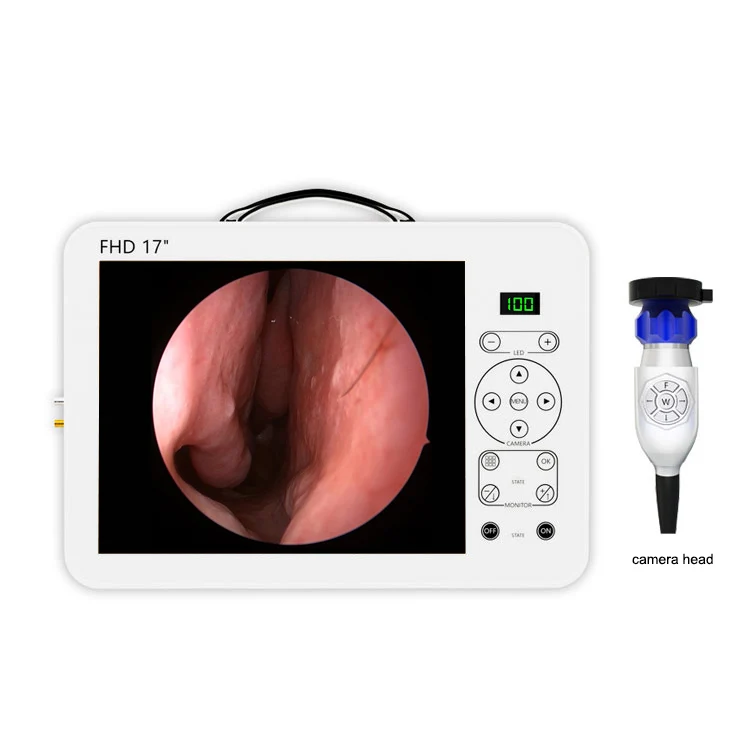 17인치 HD 비디오 오토스코프, 이비인후과 진단 시스 - Medical Lab Images 리뷰 및 가격