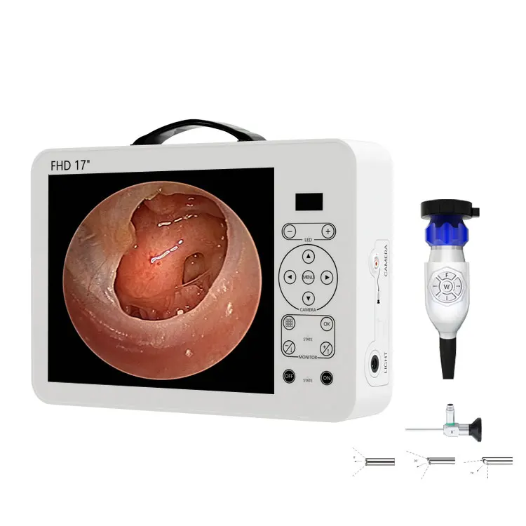 17인치 HD 비디오 오토스코프, 이비인후과 진단 시스 - Medical Lab Images 리뷰 및 가격